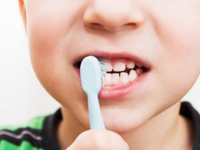 All About Hygiene: 5 Oral Healthcare Tips for Children With Special Needs